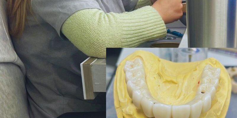 importancia_protesico_dental