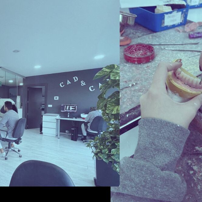 Proceso de Fabricación de Prótesis Dentales