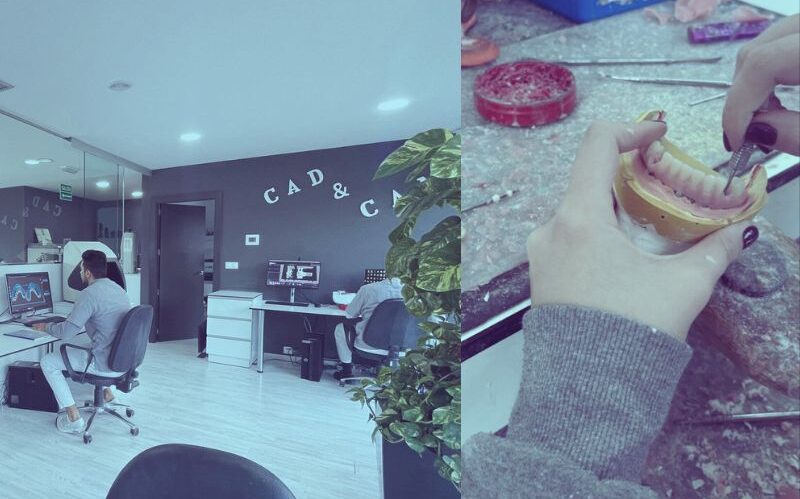 Proceso de Fabricación de Prótesis Dentales