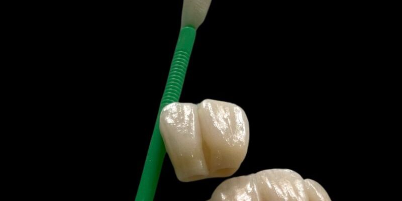historia_detras_ceramica_dental