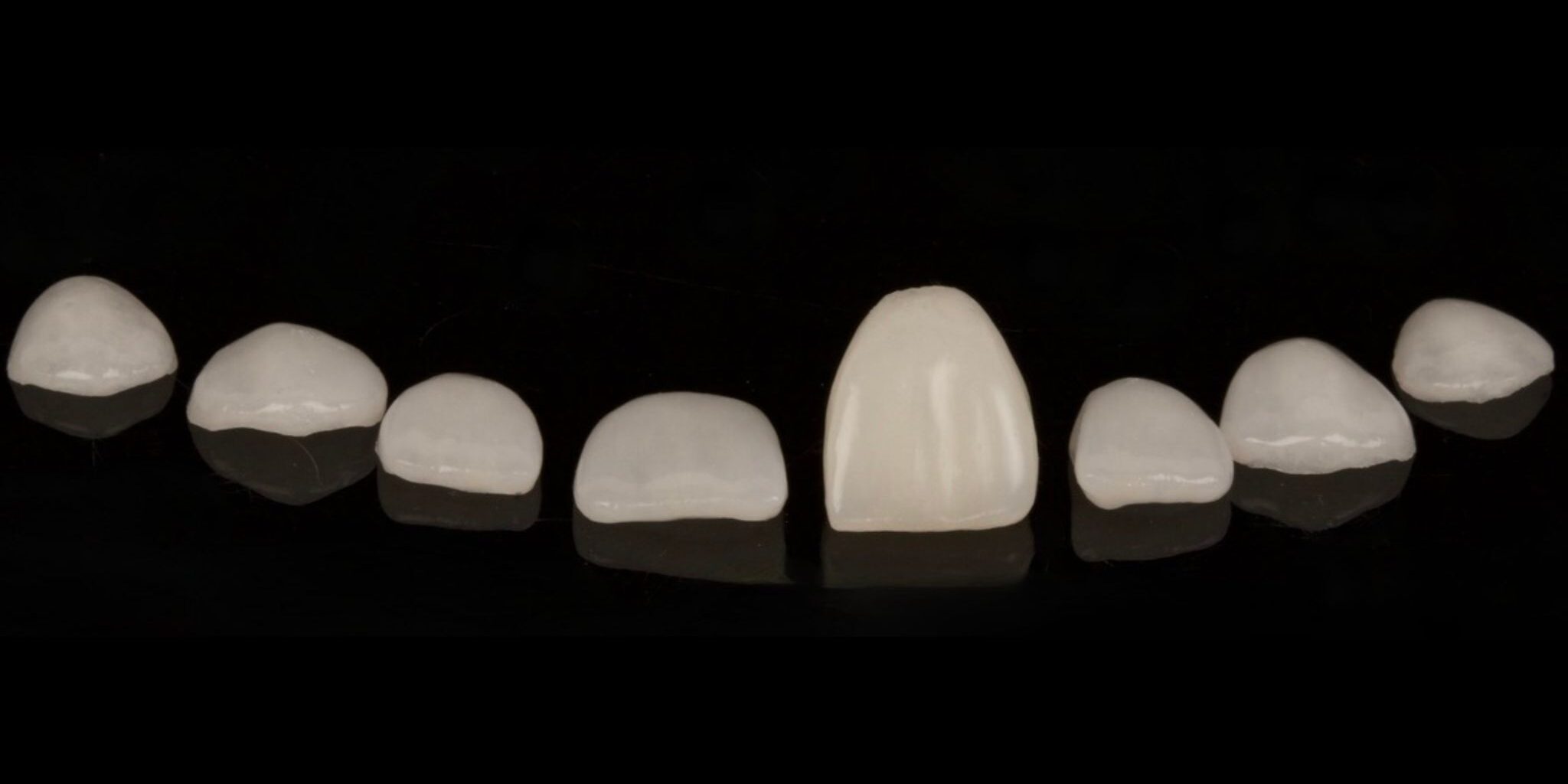 guia_completa_carillas_dentales Guía Completa sobre Carillas Dentales