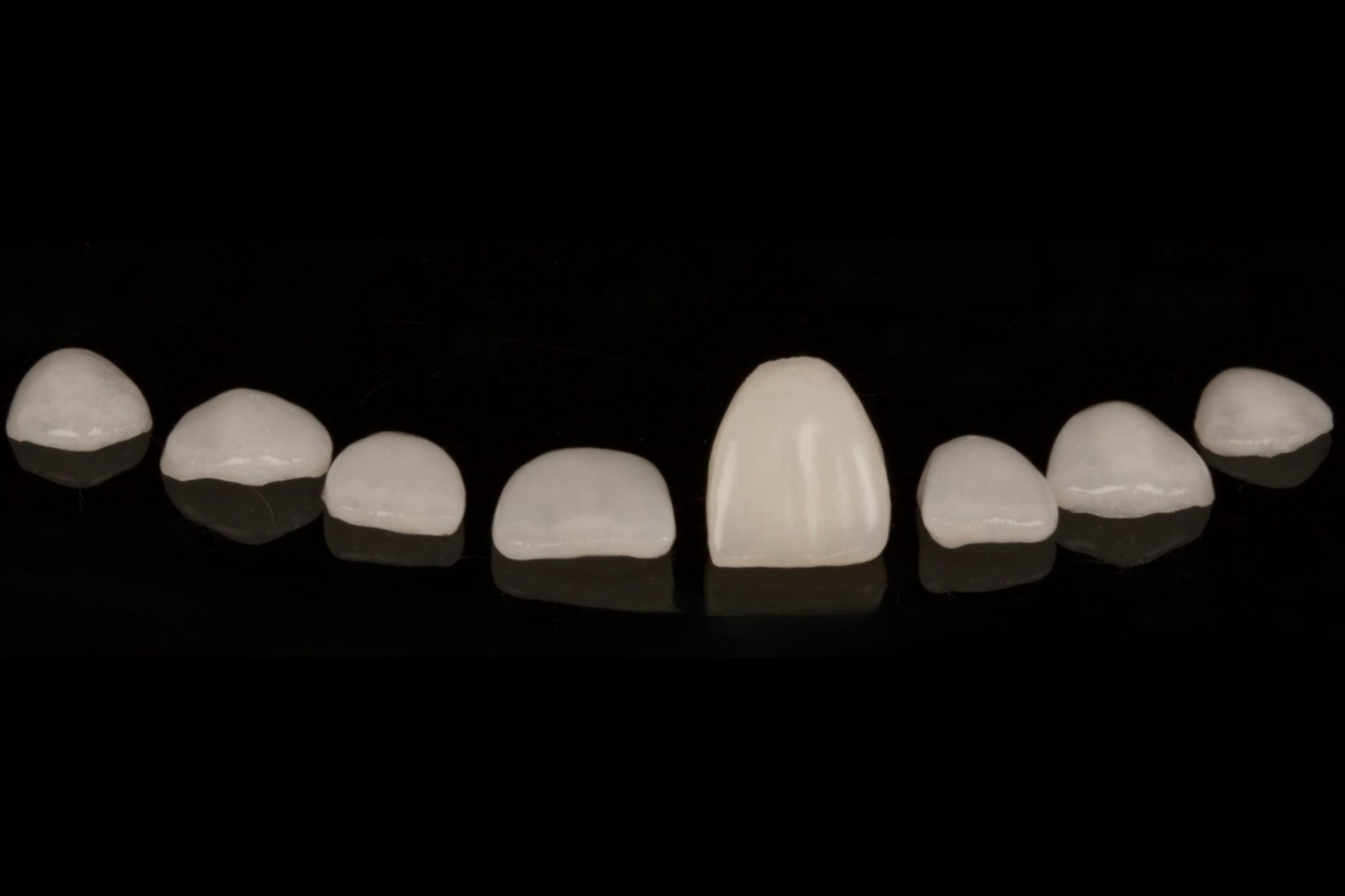 guia_completa_carillas_dentales Guía Completa sobre Carillas Dentales