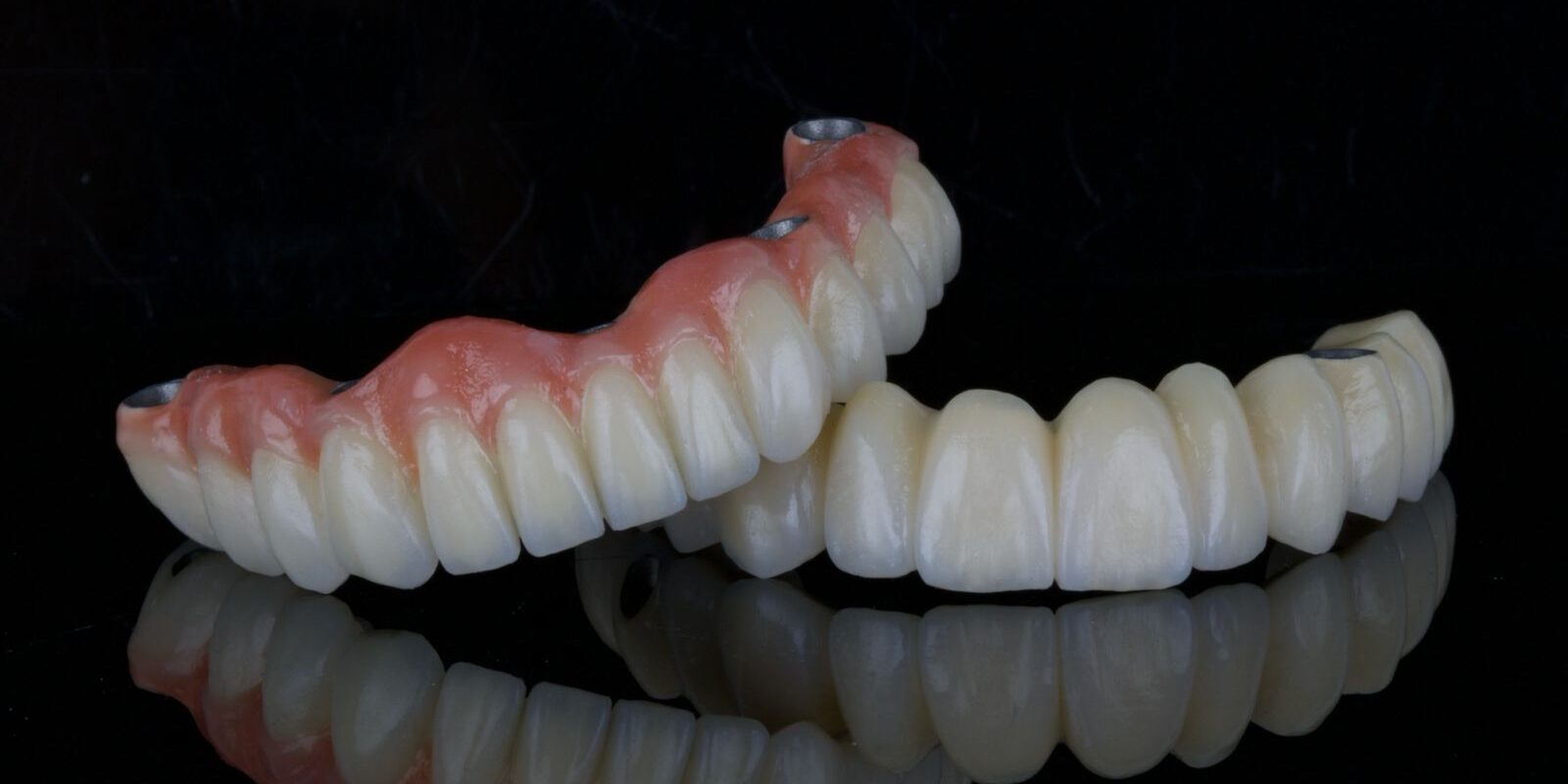 diseno_estetico_protesis_dentales