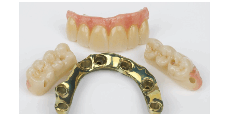 ¿Cuándo y por qué recurrir a una estructura en titanio?