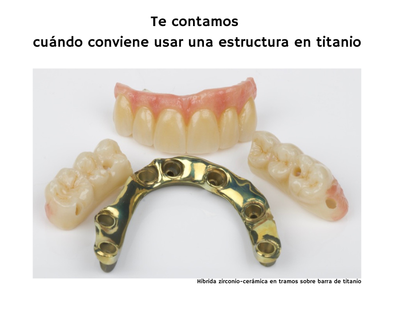 ¿Cuándo y por qué recurrir a una estructura en titanio?